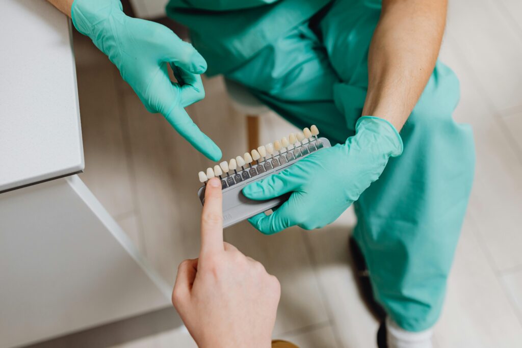 facettes dentaires : dents parfaites, sourire esthétique