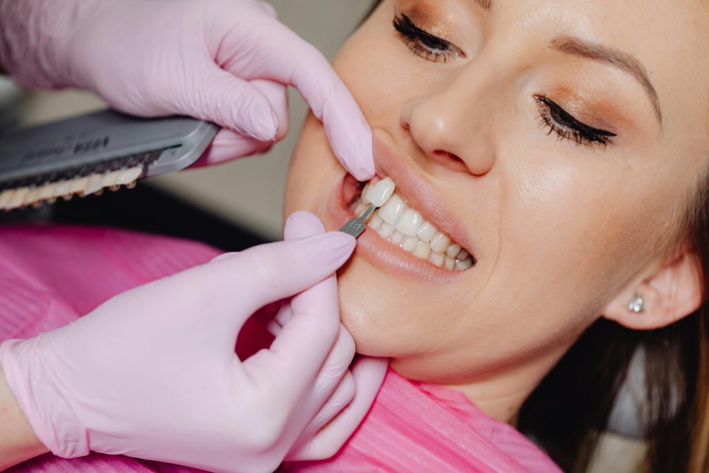 facettes dentaires : dents parfaites, sourire esthétique