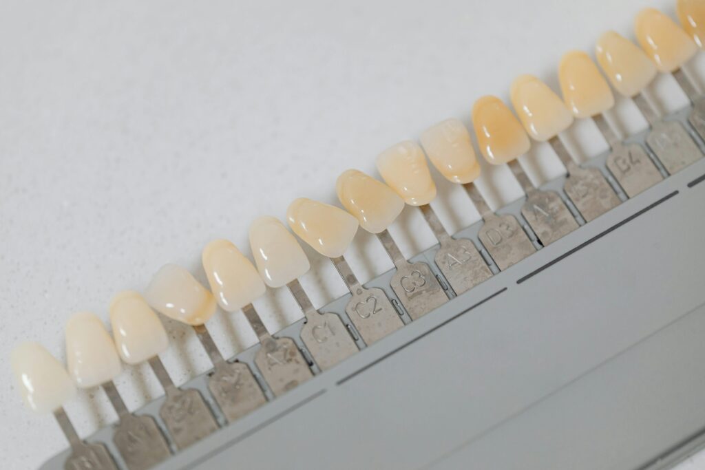 facettes dentaires : dents parfaites, sourire esthétique