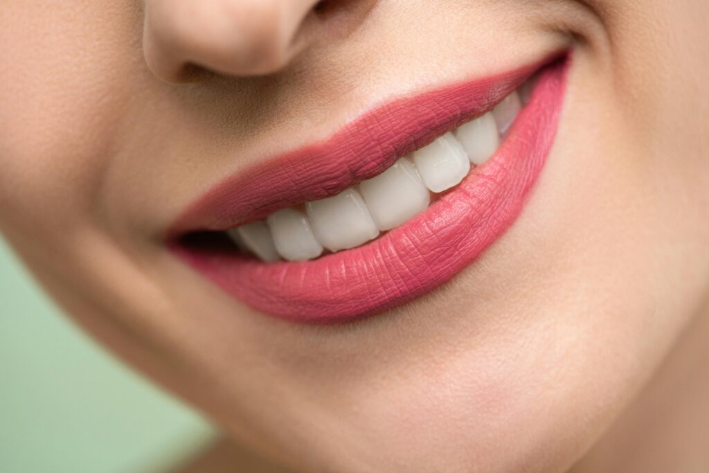 facettes dentaires : dents parfaites, sourire esthétique